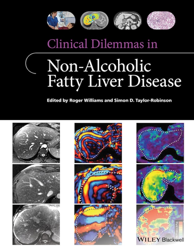 Front cover_Clinical Dilemmas in Non-Alcoholic Fatty Liver Disease