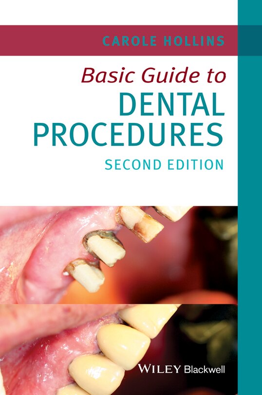 Couverture_Basic Guide to Dental Procedures