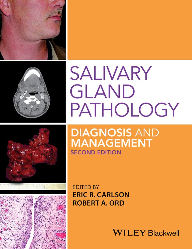 Front cover_Salivary Gland Pathology