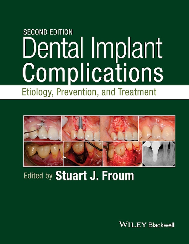 Couverture_Dental Implant Complications