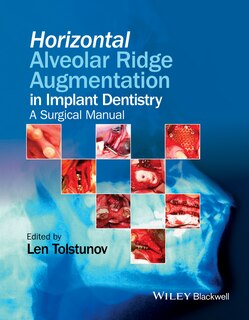 Front cover_Horizontal Alveolar Ridge Augmentation in Implant Dentistry
