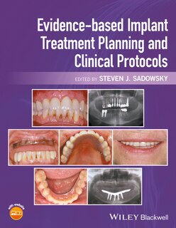 Front cover_Evidence-based Implant Treatment Planning and Clinical Protocols