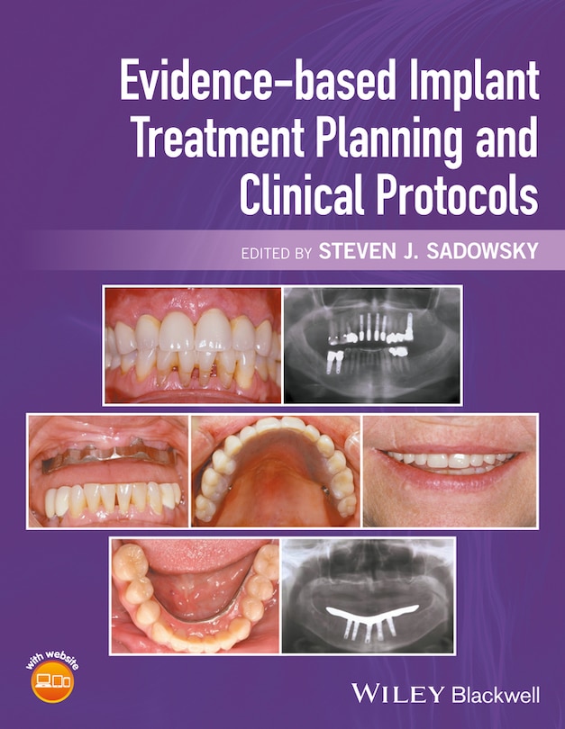 Front cover_Evidence-based Implant Treatment Planning and Clinical Protocols