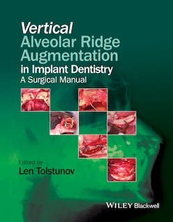 Couverture_Vertical Alveolar Ridge Augmentation in Implant Dentistry