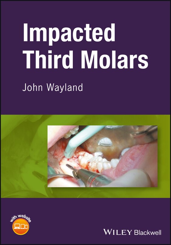 Couverture_Impacted Third Molars