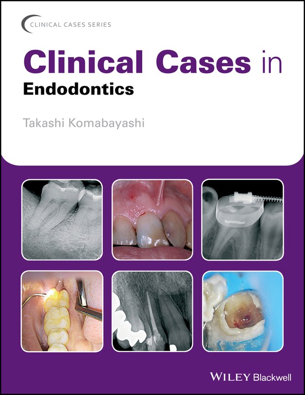 Front cover_Clinical Cases in Endodontics