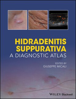 Front cover_Hidradenitis Suppurativa