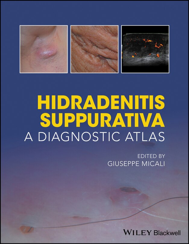 Front cover_Hidradenitis Suppurativa