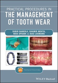 Front cover_Practical Procedures In The Management Of Tooth Wear