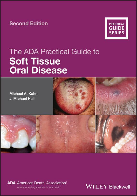 Couverture_The ADA Practical Guide to Soft Tissue Oral Disease