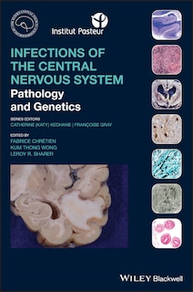 Front cover_Infections Of The Central Nervous System