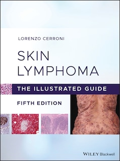 Front cover_Skin Lymphoma