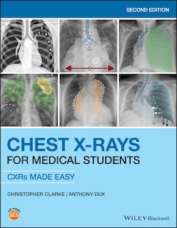 Couverture_Chest X-rays For Medical Students