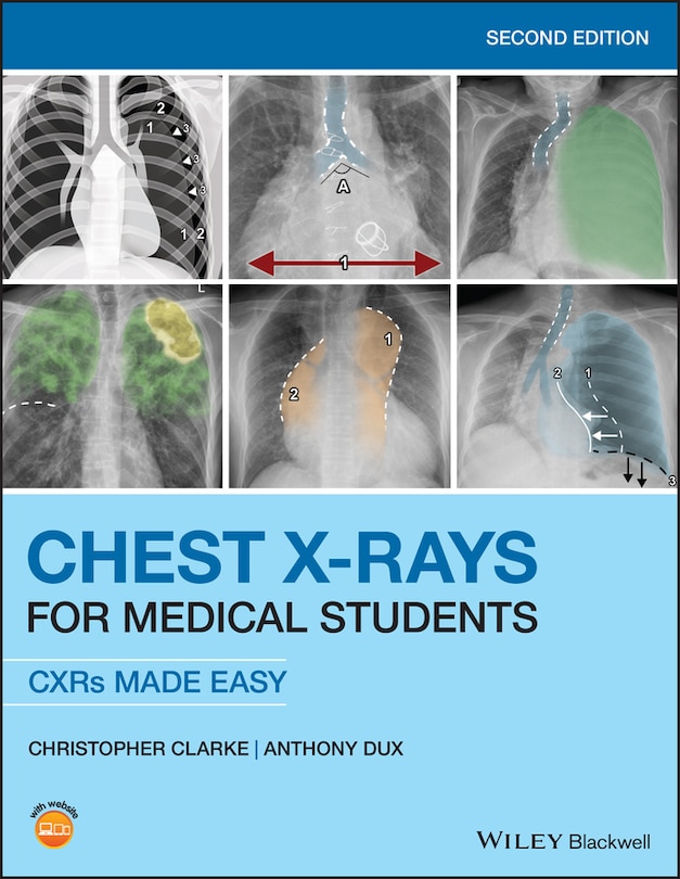 Couverture_Chest X-rays For Medical Students