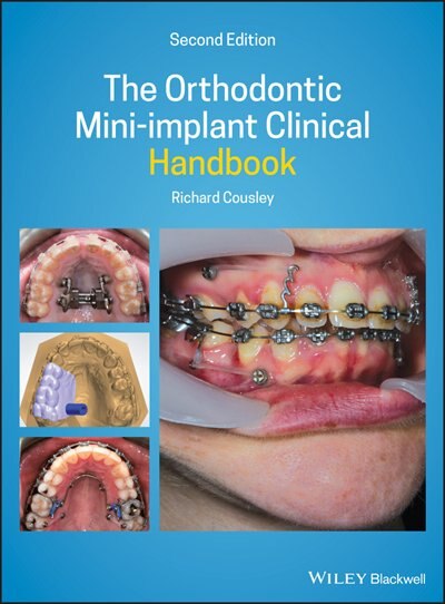 Couverture_The Orthodontic Mini-implant Clinical Handbook