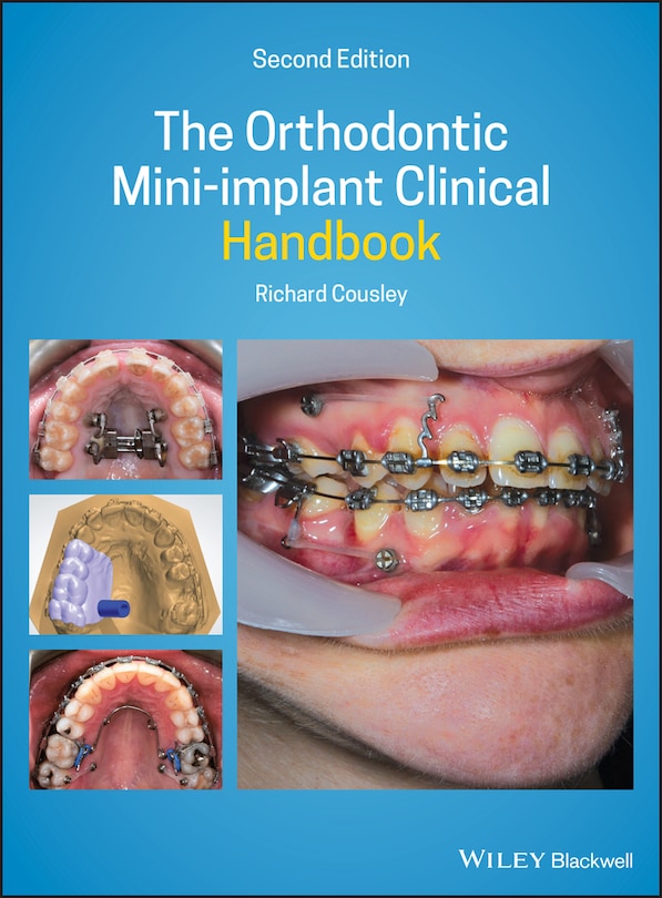 Couverture_The Orthodontic Mini-implant Clinical Handbook