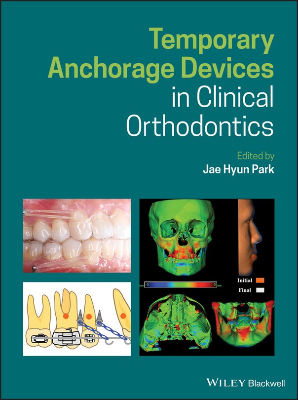 Couverture_Temporary Anchorage Devices In Clinical Orthodontics