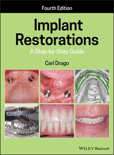 Front cover_Implant Restorations