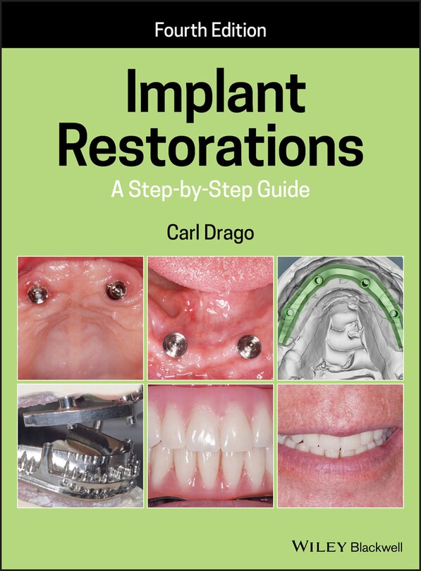 Front cover_Implant Restorations