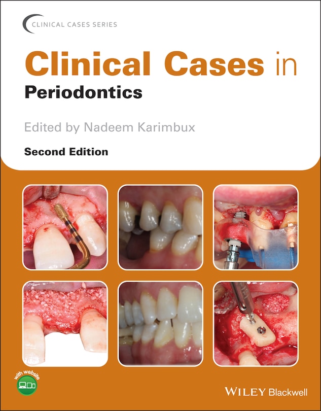 Front cover_Clinical Cases In Periodontics