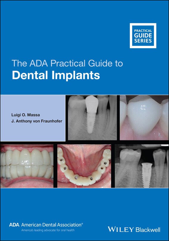 Front cover_The Ada Practical Guide To Dental Implants