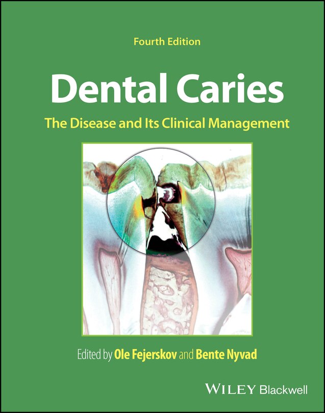 Couverture_Dental Caries