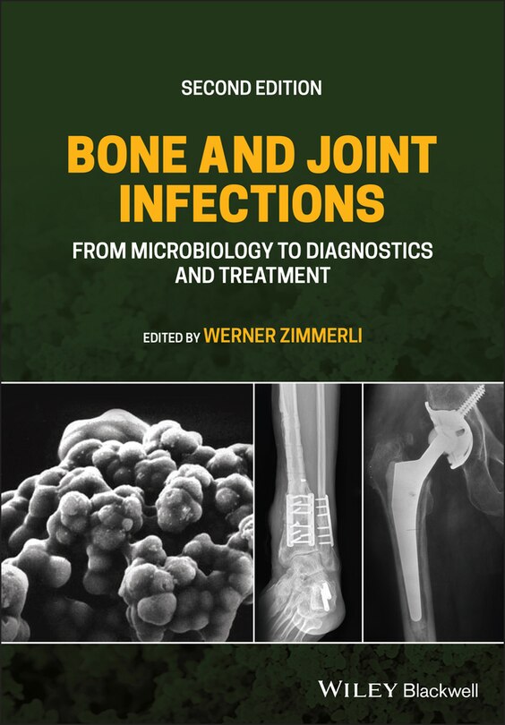 Front cover_Bone And Joint Infections