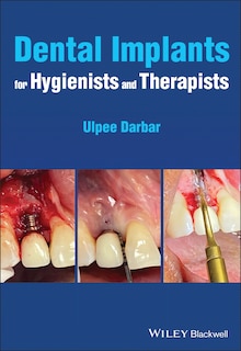 Front cover_Dental Implants For Hygienists And Therapists