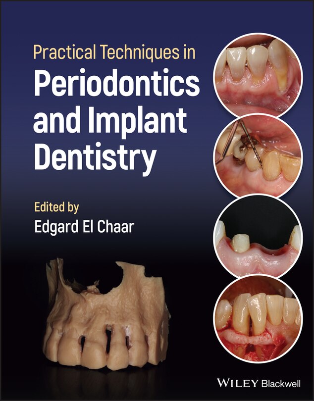 Front cover_Practical Techniques in Periodontics and Implant Dentistry