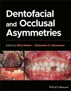 Couverture_Dentofacial and Occlusal Asymmetries