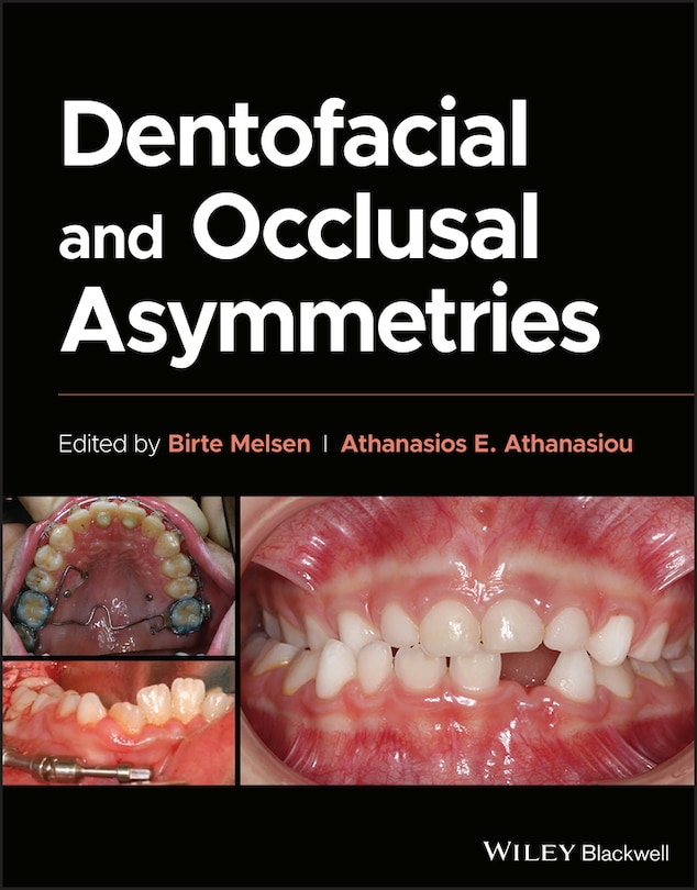 Couverture_Dentofacial and Occlusal Asymmetries