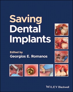 Couverture_Saving Dental Implants