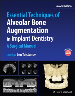 Couverture_Essential Techniques Of Alveolar Bone Augmentation In Implant Dentistry