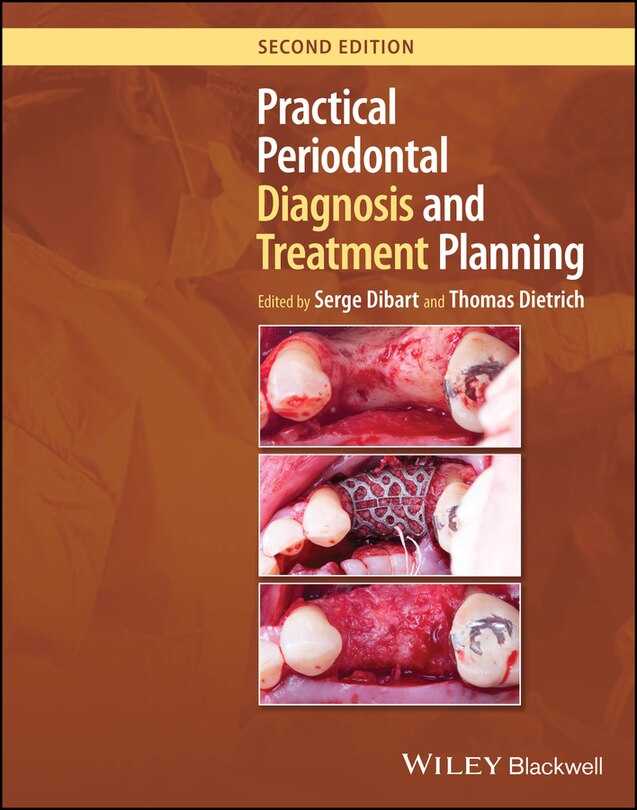 Front cover_Practical Periodontal Diagnosis and Treatment Planning