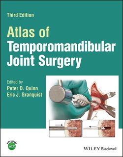 Front cover_Atlas Of Temporomandibular Joint Surgery