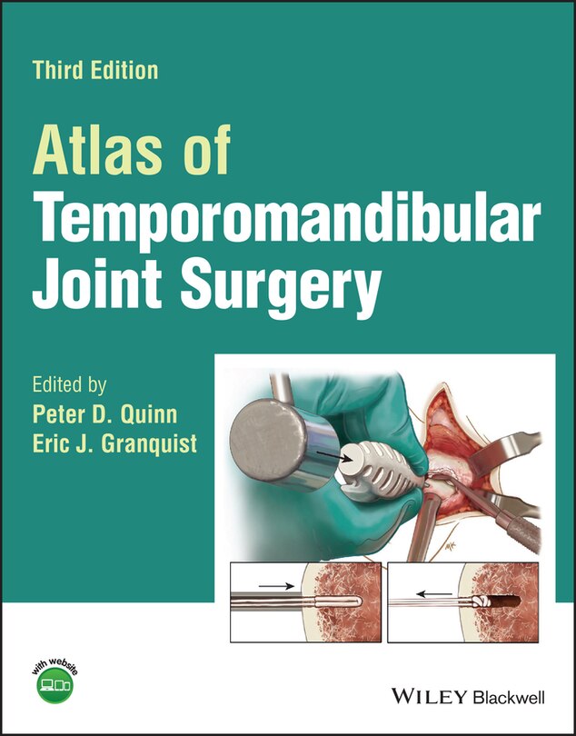 Front cover_Atlas Of Temporomandibular Joint Surgery