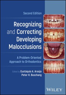 Front cover_Recognizing and Correcting Developing Malocclusions