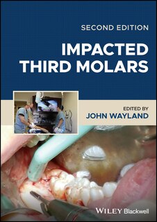 Front cover_Impacted Third Molars