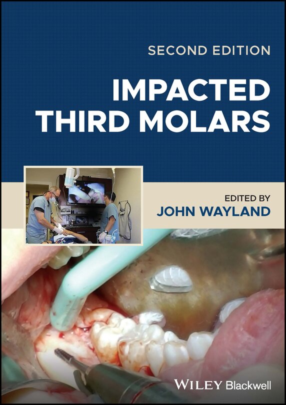 Front cover_Impacted Third Molars