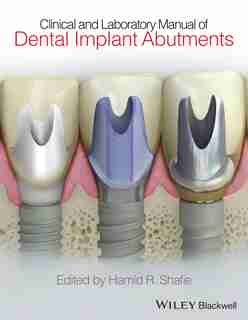 Clinical and Laboratory Manual of Dental Implant Abutments by Hamid R. Shafie