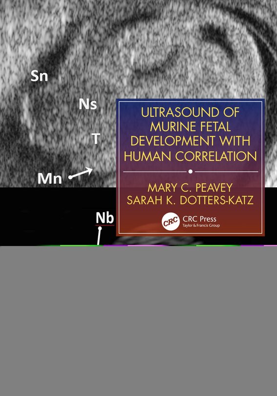 Couverture_Ultrasound Of Mouse Fetal Development And Human Correlates