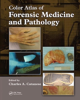 Front cover_Color Atlas Of Forensic Medicine And Pathology