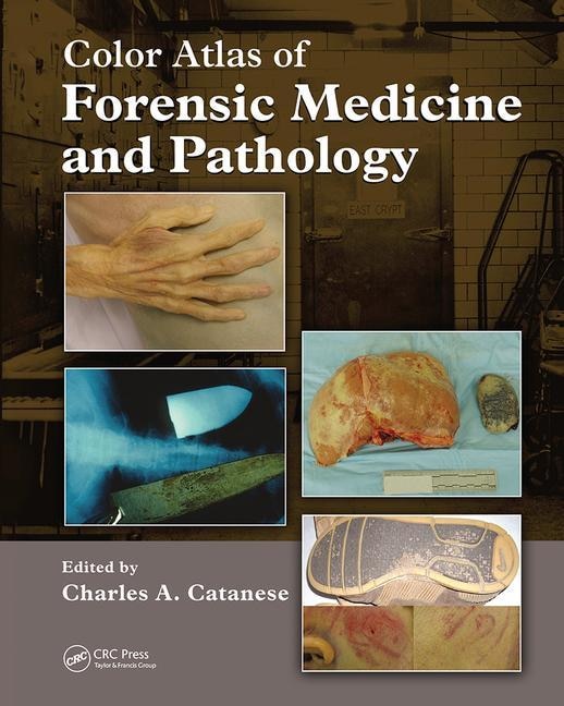 Front cover_Color Atlas Of Forensic Medicine And Pathology