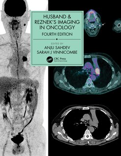 Front cover_Husband And Reznek's Imaging In Oncology