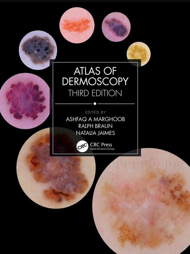 Front cover_Atlas Of Dermoscopy