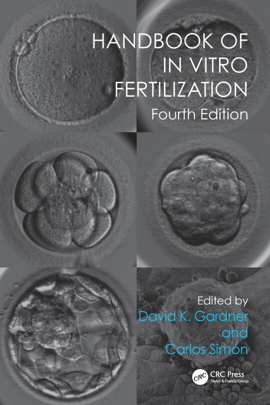 Front cover_Handbook Of In Vitro Fertilization