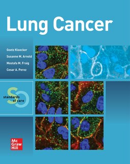 Couverture_Lung Cancer:  Standards of Care