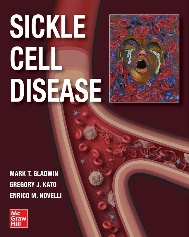 Front cover_Sickle Cell Disease