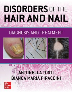Front cover_Disorders of the Hair and Nail: Diagnosis and Treatment