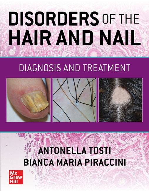 Front cover_Disorders of the Hair and Nail: Diagnosis and Treatment